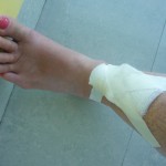 Day3BandagedLeg800x600 (A Dash to Nha Trang: Day 3 – Bliss and Ack!)